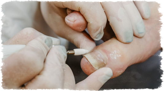 Fußpflege Eine Nahaufnahme eines Fußnagels, der mit einem Fräser in Form gebracht wird. Die Hand einer Person hält den Zeh fest, während der Fräser vorsichtig über den Nagel geführt wird.